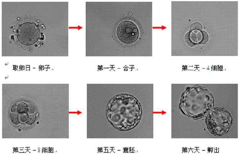 囊胚培养的过程