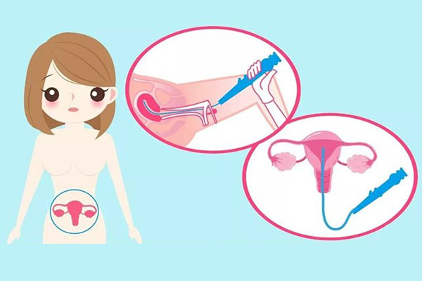 保养子宫内膜的日常小妙招