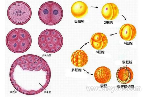 俄罗斯试管婴儿多囊卵巢综合征