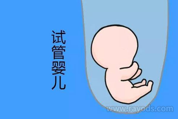 俄罗斯第三代试管婴儿