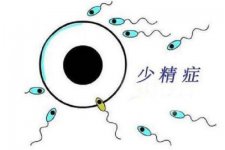 男性为什么会患上少精症?患上少精症一定不育吗?