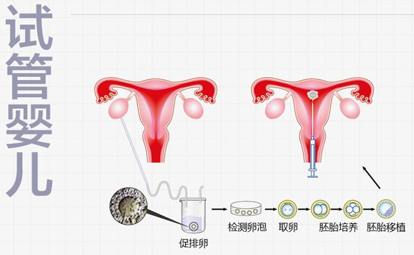移植前为什么要打降调