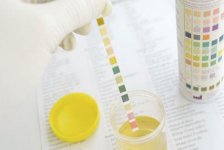 最简单的土方法验孕不用试纸也照样能检测出早孕
