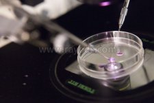 简单了解试管婴儿技术