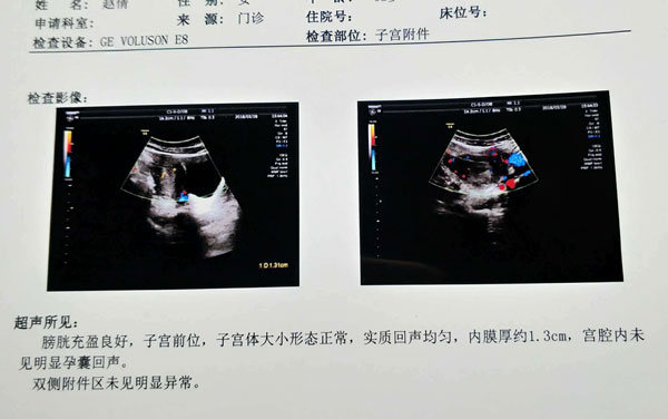 预测生男生女的方法