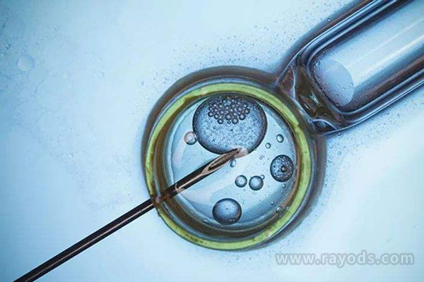 超长方案一般取卵多吗