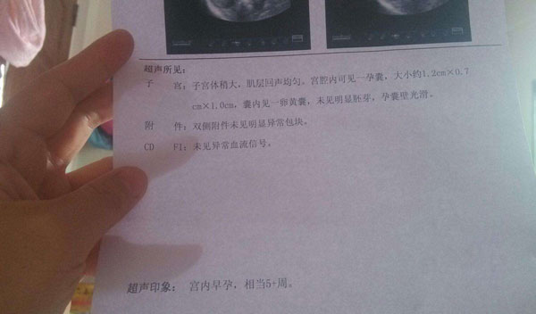 初次B超检查