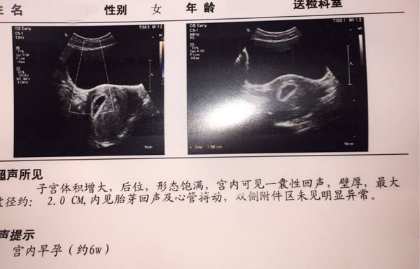 2次检查是否要进行则需要看第一次检查结果