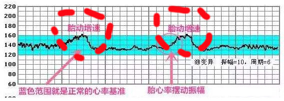 胎心率