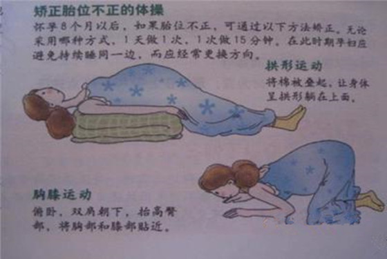 胎位不正的类型总结