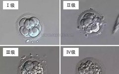 囊胚4bb，5bb哪个级别和成功率要高一些？
