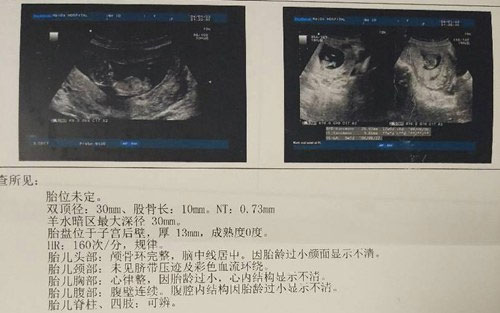 NT单子上有男女标志吗