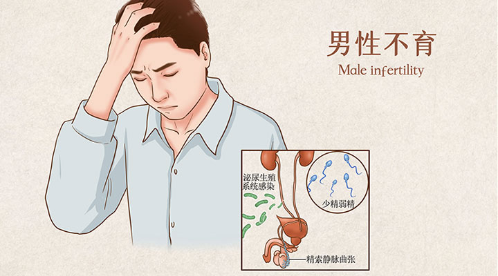 死精症表现为不孕
