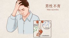 患上死精症的表现有哪些？早泄是常见症状吗？