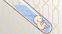 无精症治疗后能做试管婴儿生育自己的孩子吗？