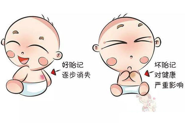 什么是胎记