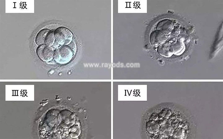 胚胎等级
