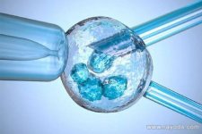 48岁高龄孕妇赴泰国做试管能怀上孩子么?在国内可以么?