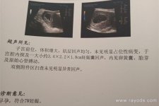 孕囊看男女的方法是什么？四十天孕囊圆形百分百女孩真的吗？