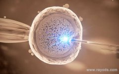 3万够在乌克兰AMC生殖医院做试管的生活花销吗？