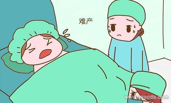 生产时大出血