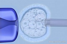 试管辅助孵化的好处与坏处，辅助孵化能提高成功率吗？