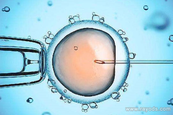 柬埔寨皇家生殖医院供精试管婴儿