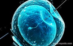 女性免疫性不孕去俄罗斯MD医疗集团做试管有用么？