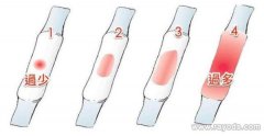 月经量少能怀上宝宝吗？月经量少平时应注意些什么