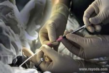 美国试管婴儿专家：从4个方面确保IVF的安全性