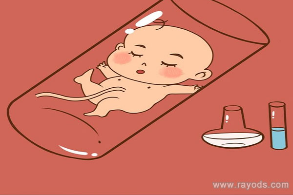 试管婴儿