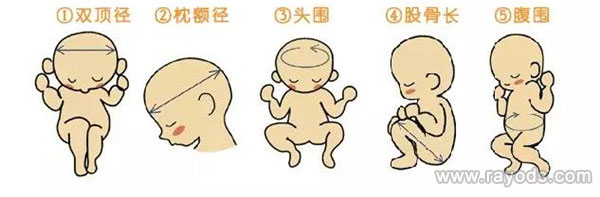 怀儿子双顶径一般都会大吗 胎儿双顶径偏大怎么办