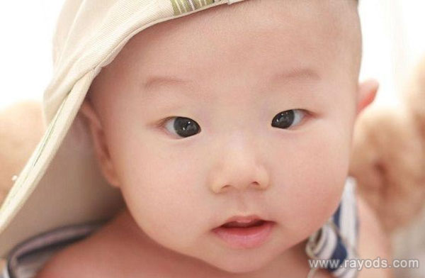 内斜视就会出现斗鸡眼现象
