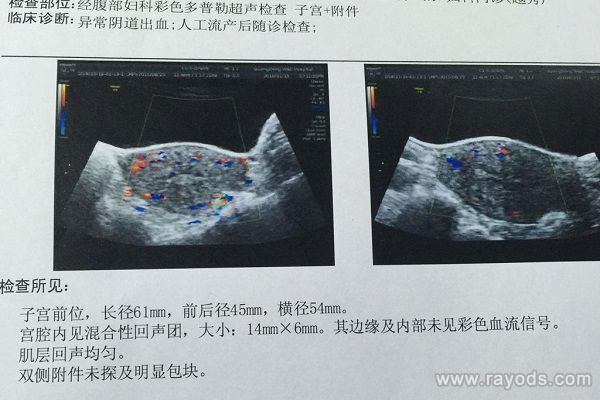 临床血块检查