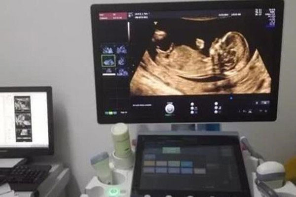 nt值看孩子以后智商 nt值越低孩子越聪明的真相