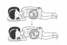 胎位臀位是睡太多的原因吗 胎儿臀位如何纠正能否顺产