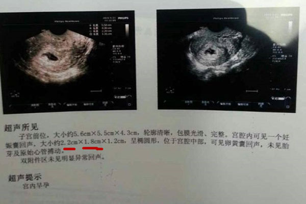 b超单有这个一般是女孩 这些个数据要看仔细了