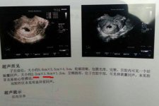 b超单有这个一般是女孩 这些个数据要看仔细了
