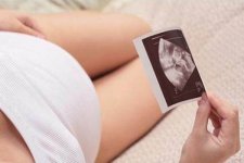 100%准确测试男孩女孩 不用B超、验血测试方法