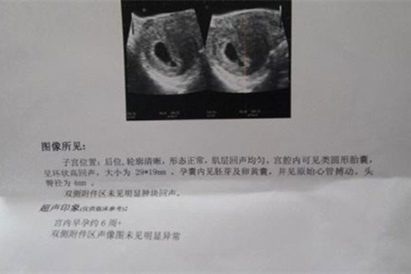 b超图怎么看图解