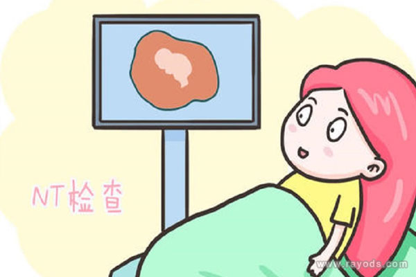 nt检查有两种方式