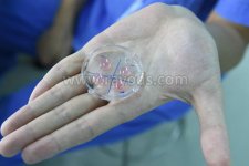 34岁做7次试管婴儿移植反复失败的原因