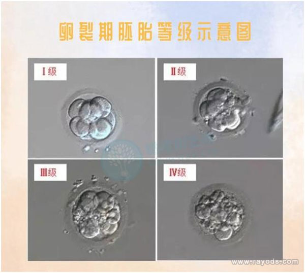 D3胚胎等级怎么分