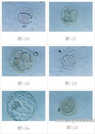胚胎图片