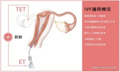 试管婴儿流程介绍