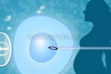 试管前要如何调养？科学饮食、运动帮助养卵提高成功率