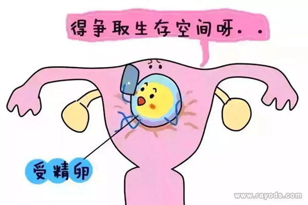 不同类型的宫腔粘连症状