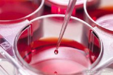 人绒毛膜促性腺激素(HCG)是什么？有什么作用？