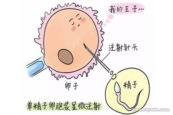 做试管婴儿到底选择哪一代好