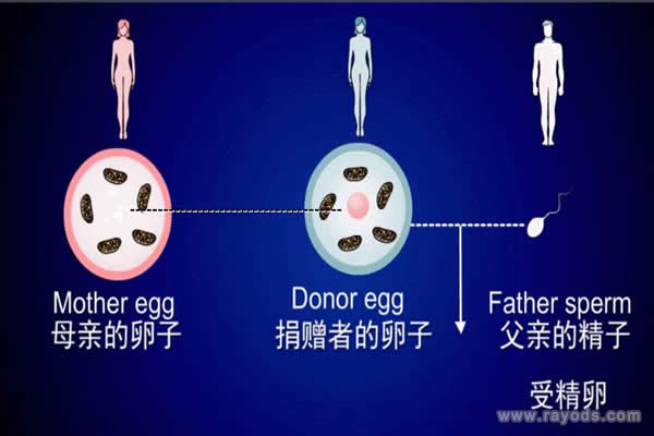做试管婴儿到底选择哪一代好